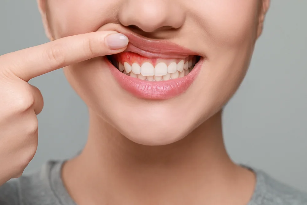 Why Seeing a Periodontal Disease Dentist Is Critical for Gum Disease Care