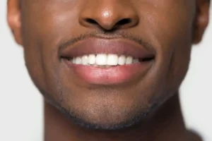 Understanding Infection Risks After Bone Graft Surgery