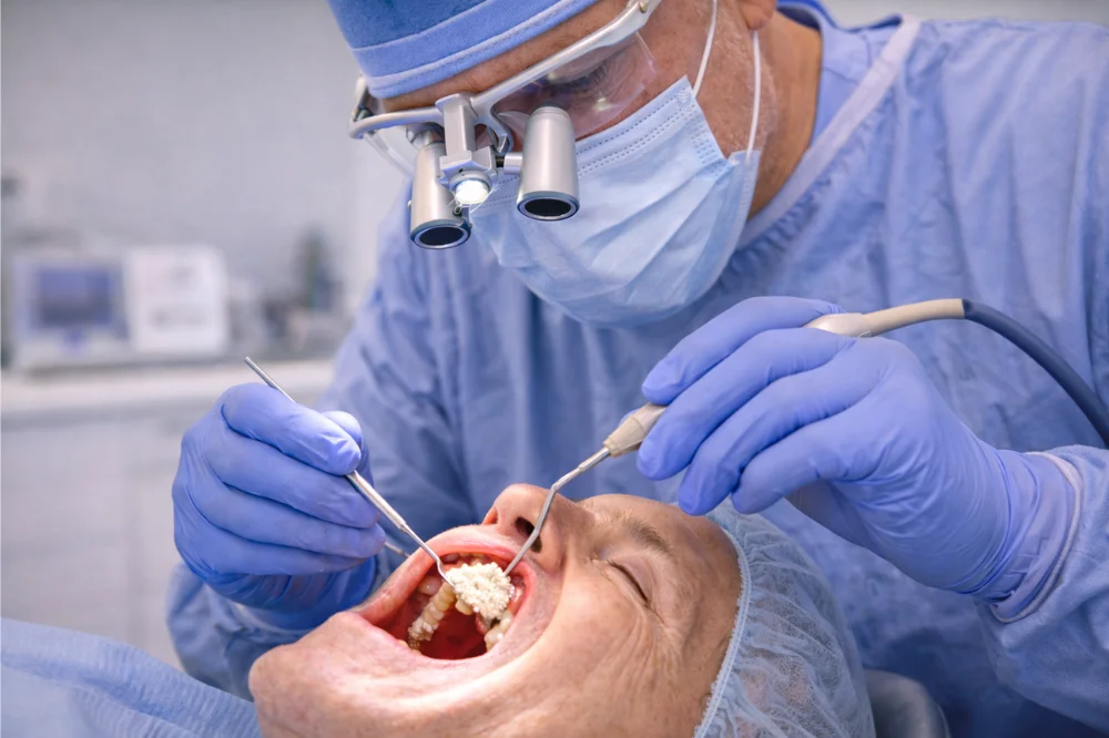 Sinus Lift: What Happens During Your Bone Grafting Surgery